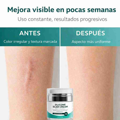 Silicone Scare Cream® - Crema Reparadora de Cicatrices