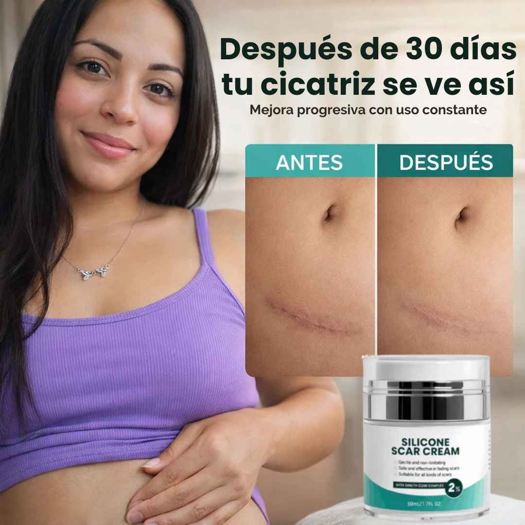 Silicone Scare Cream® - Crema Reparadora de Cicatrices - Vexori